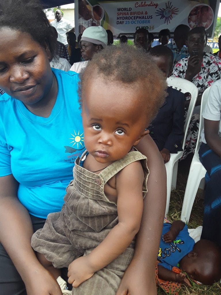 Spina Bifida And Hydrocephalus Patients Decry Neglect From Public 20171025 114239